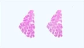 Frozen Tissue Section - Human Adult Normal: Heart: Arcus Aortae