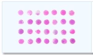 Frozen Tissue Array - 37 Different Colon Tumors and 3 Corresponding Normal Controls