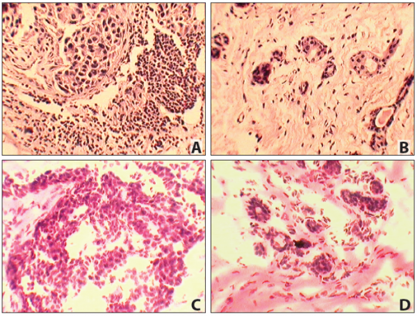 Matched Pair - Frozen Tissue Section - Human Primary and Matched Metastatic Tumor (PM): Colon